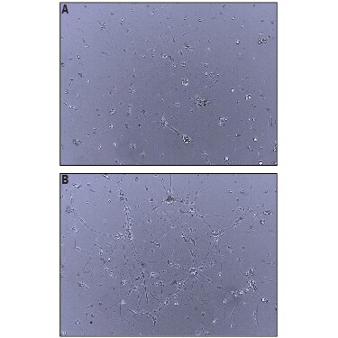 Recombinant Human Neuroligin 4Y/NLGN4Y Protein Bioactivity