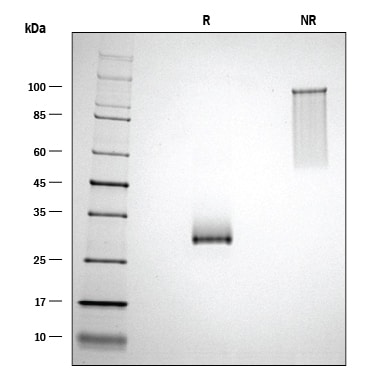 ProDots Recombinant Human Noggin Protein SDS-PAGE