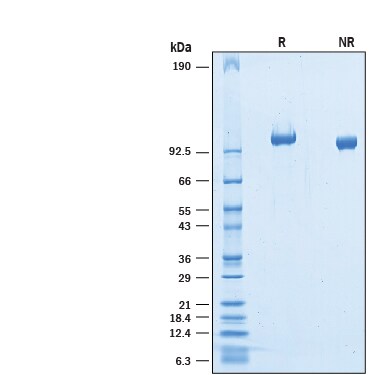 Recombinant Mouse OCAM/NCAM2 His-tag Protein SDS-PAGE