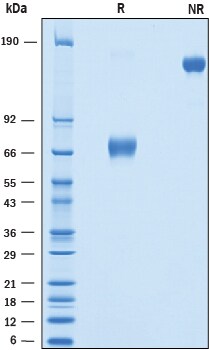 Recombinant Human OLT-2/TARM1 Fc Chimera Protein SDS-PAGE