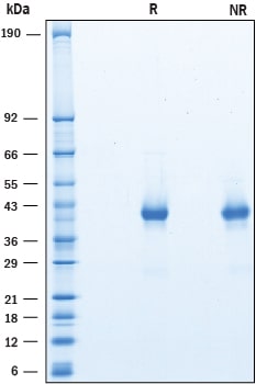 Recombinant Human OX40/TNFRSF4 His-tag Protein SDS-PAGE
