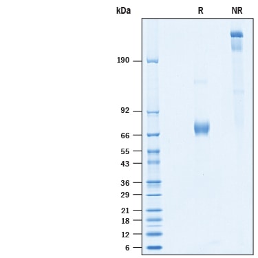Recombinant Human Olfactomedin-4/OLFM4 His-tag Protein SDS-PAGE