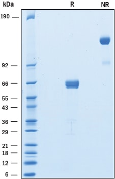 Recombinant Rat PD-1 Fc Chimera Protein SDS-PAGE