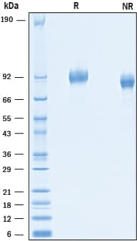 Recombinant Mouse PDGF R alpha His-tag Protein SDS-PAGE