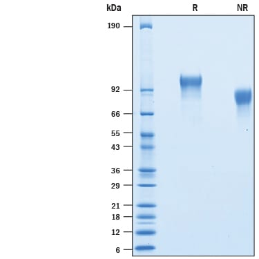 Recombinant Human PDGF R alpha His-tag Avi-tag Protein SDS-PAGE
