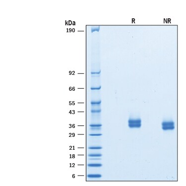 Recombinant Cynomolgus Monkey PD-L1/B7-H1 His Protein SDS-PAGE