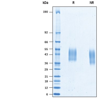 Recombinant Porcine PD-L1/B7-H1 His-tag Protein SDS-PAGE