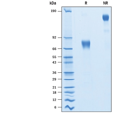 Recombinant Porcine PD-L1/B7-H1 Fc Chimera Protein SDS-PAGE