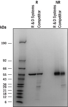 Recombinant Human PHGDH His-tag SDS-PAGE