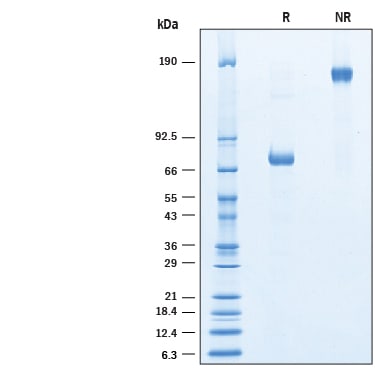 Recombinant Human PON1 His-tag Fc Chimera Protein SDS-PAGE