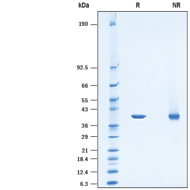 Recombinant Human PSAT1 His-tag Protein SDS-PAGE