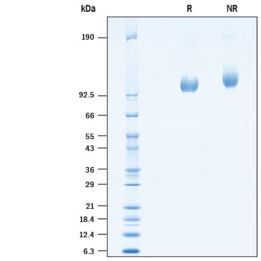 Recombinant Cynomolgus PSMA/FOLH1/NAALADase I Protein SDS-PAGE
