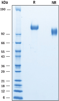 Recombinant Mouse P-Selectin/CD62P His-tag Protein SDS-PAGE