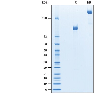 Recombinant Mouse PTK7/CCK4 Fc Chimera Protein SDS-PAGE