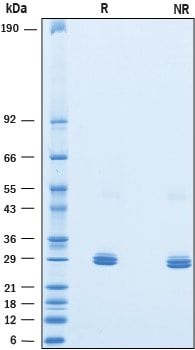 Recombinant Human Pentraxin 2/SAP His-tag Protein SDS-PAGE