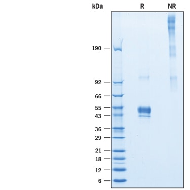 Recombinant Human Pentraxin 3/TSG-14 His-tag Protein SDS-PAGE