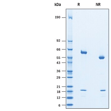 Recombinant Cynomolgus Monkey PCSK9 His-tag Protein SDS-PAGE