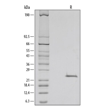 Recombinant Mouse R-Spondin 1 Protein SDS-PAGE