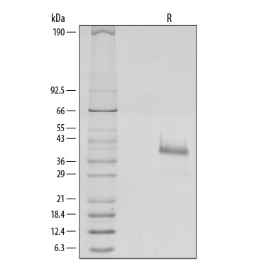 Recombinant Human R-Spondin 1 Protein SDS-PAGE
