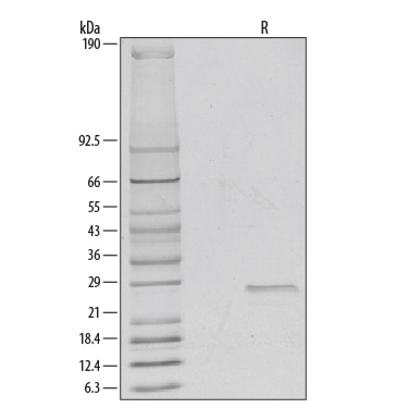 Recombinant Human R-Spondin 2 Protein SDS-PAGE