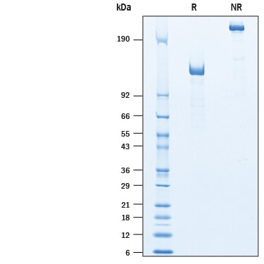 Recombinant Human RECK Fc Chimera Protein SDS-PAGE
