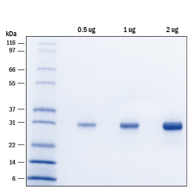Recombinant Human RNF114 Protein SDS-PAGE