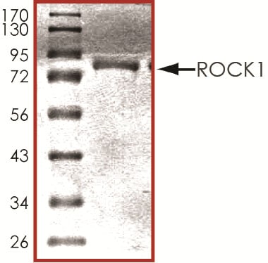 Recombinant Human Active ROCK1 Protein SDS-PAGE