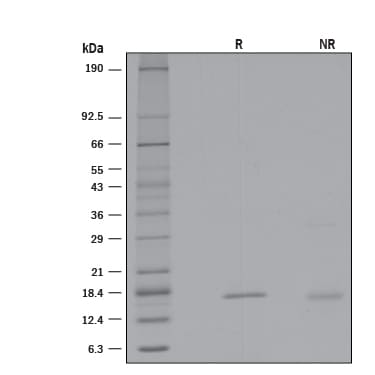 Recombinant Human Reg1B Protein SDS-PAGE