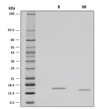 Recombinant Rat Reg3B Protein SDS-PAGE