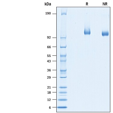 Recombinant Human Ret His-tag Protein SDS-PAGE
