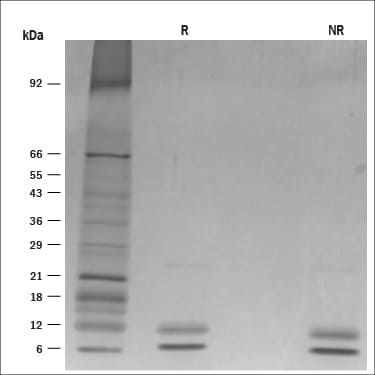 Recombinant Mouse S100A8/S100A9 Heterodimer Protein SDS-PAGE