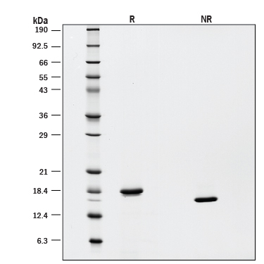 Recombinant Human SCF GMP Protein SDS-PAGE