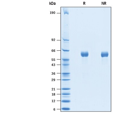Recombinant Human SCG3 His-tag Protein SDS-PAGE