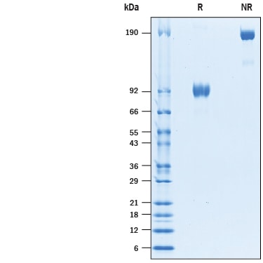 Recombinant Human SIRP alpha/CD172a Fc Avi-tag Protein SDS-PAGE