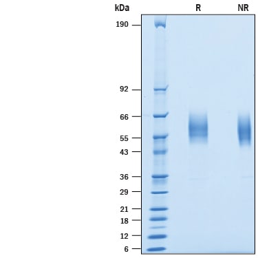 Recombinant Human SIRP alpha/CD172a His Avi-tag Protein SDS-PAGE