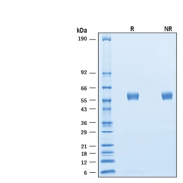 Recombinant Cynomolgus SIRP beta 1/CD172b His Protein SDS-PAGE