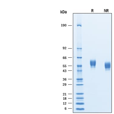Recombinant Human SIRP beta 1/CD172b Protein SDS-PAGE