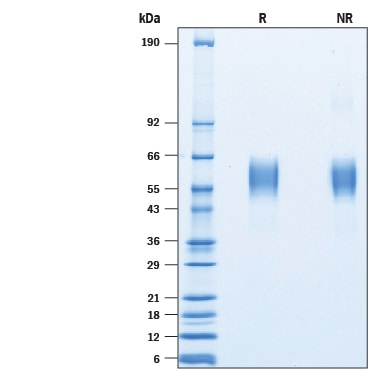 Recombinant Mouse SIRP beta 1a His-tag Protein SDS-PAGE