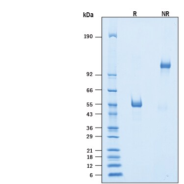 Recombinant Human SIRP delta Fc Chimera Protein SDS-PAGE