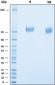 Recombinant Mouse SLITRK3 His-tag Protein SDS-PAGE