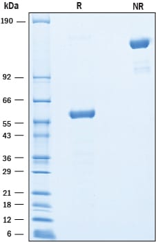Recombinant Human TMED1 Fc Chimera Protein SDS-PAGE