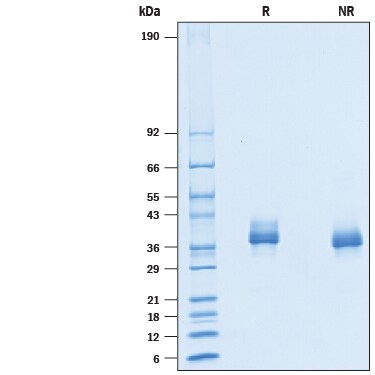 Recombinant Mouse Siglec-15 His-tag Protein SDS-PAGE