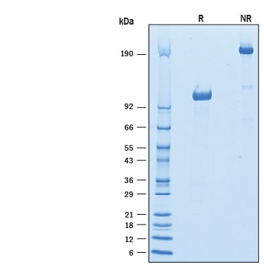 Recombinant Mouse Siglec-G Fc Chimera Protein SDS-PAGE