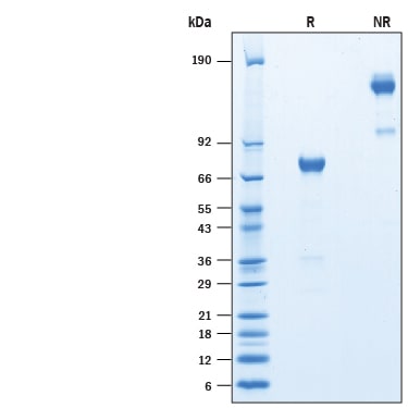Recombinant Mouse Siglec-H Fc Chimera Protein SDS-PAGE