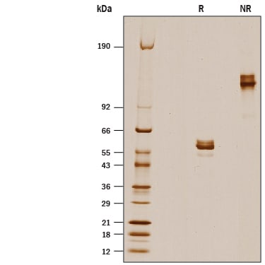 Recombinant Mouse Skint2/B7S3 Fc Chimera Protein SDS-PAGE
