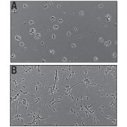 Recombinant Human Slit3 (aa 34-1116) Protein Bioactivity