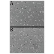 Recombinant Mouse Slit3 (aa 1117-1523) Protein Bioactivity
