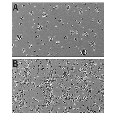 Recombinant Mouse Slit3 (aa 34-1116) Protein Bioactivity