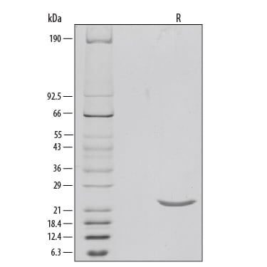 Recombinant Human Sonic Hedgehog/Shh, N-Terminus Protein SDS-PAGE