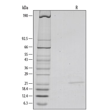 Recombinant Mouse Sonic Hedgehog/Shh (C25II) N-Terminus SDS-PAGE